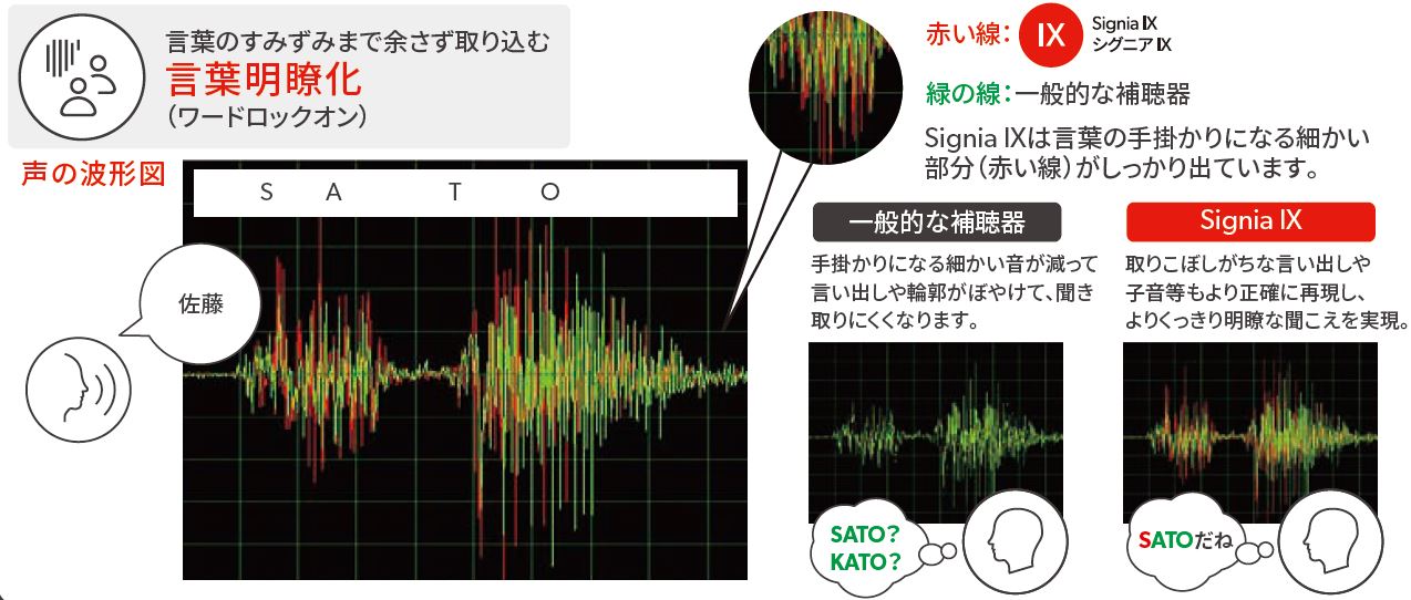 補聴器 最小クラスの充電耳あな型 シグニア Silk Charge＆Go（シルク チャージアンドゴー）IX - 愛媛の認定補聴器専門店 アズマ補聴器 センター（キコット株式会社）